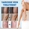 Varicose Veins Treatment for Legs, Blue Light Therapy Varicose Veins Pen for Spider Veins (1 Pen+1 Gel)